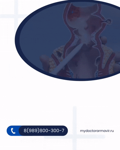 ОПЕРАТИВНОЕ ЛЕЧЕНИЕ ГЕМОРРОЯ В АРМАВИРЕ | ЦЕНТР АМБУЛАТОРНОЙ ХИРУРГИИ