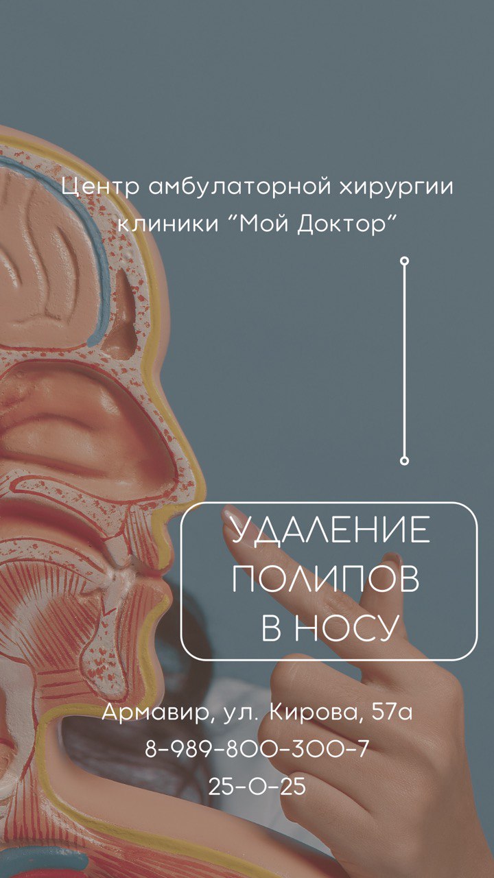 Удаление полипов в носу (взрослым и детям) в Армавире