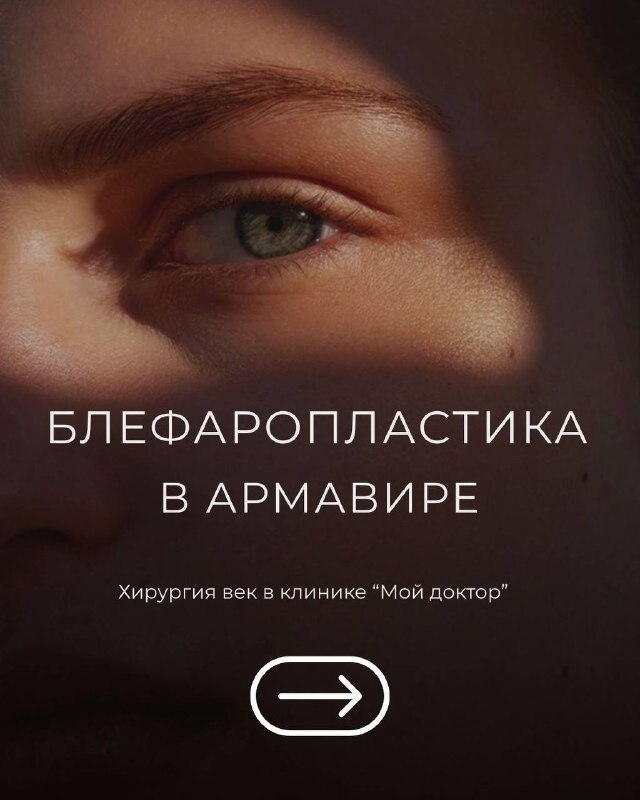 БЛЕФАРОПЛАСТИКА В АРМАВИРЕ | НАВИСШЕЕ ВЕКО