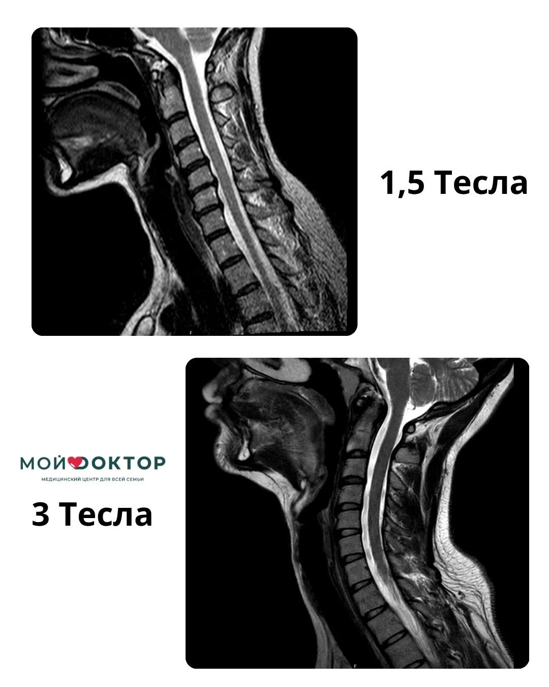 МРТ 3 ТЕСЛА В АРМАВИРЕ | ДИАГНОСТИКА СЛОЖНЫХ СЛУЧАЕВ