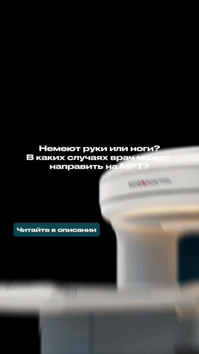 Онемение рук и ног: когда врач может назначить МРТ