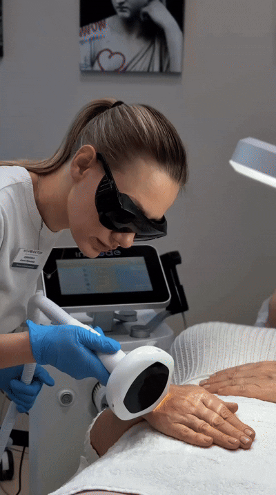 Как убрать пигментные пятна на лице. Аппаратная косметология в Армавире