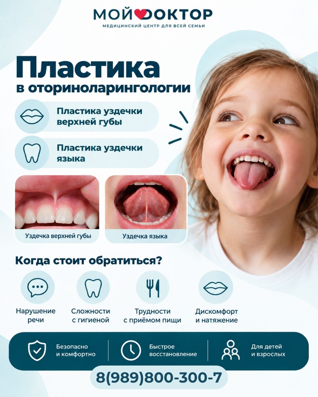 Пластика уздечки языка и верхней губы в Армавире — «Мой Доктор»